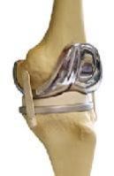 Artificial Body Parts