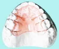 Orthodontic Appliances