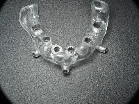 Facial Surgical Implants