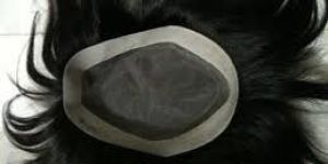 Hair Patches